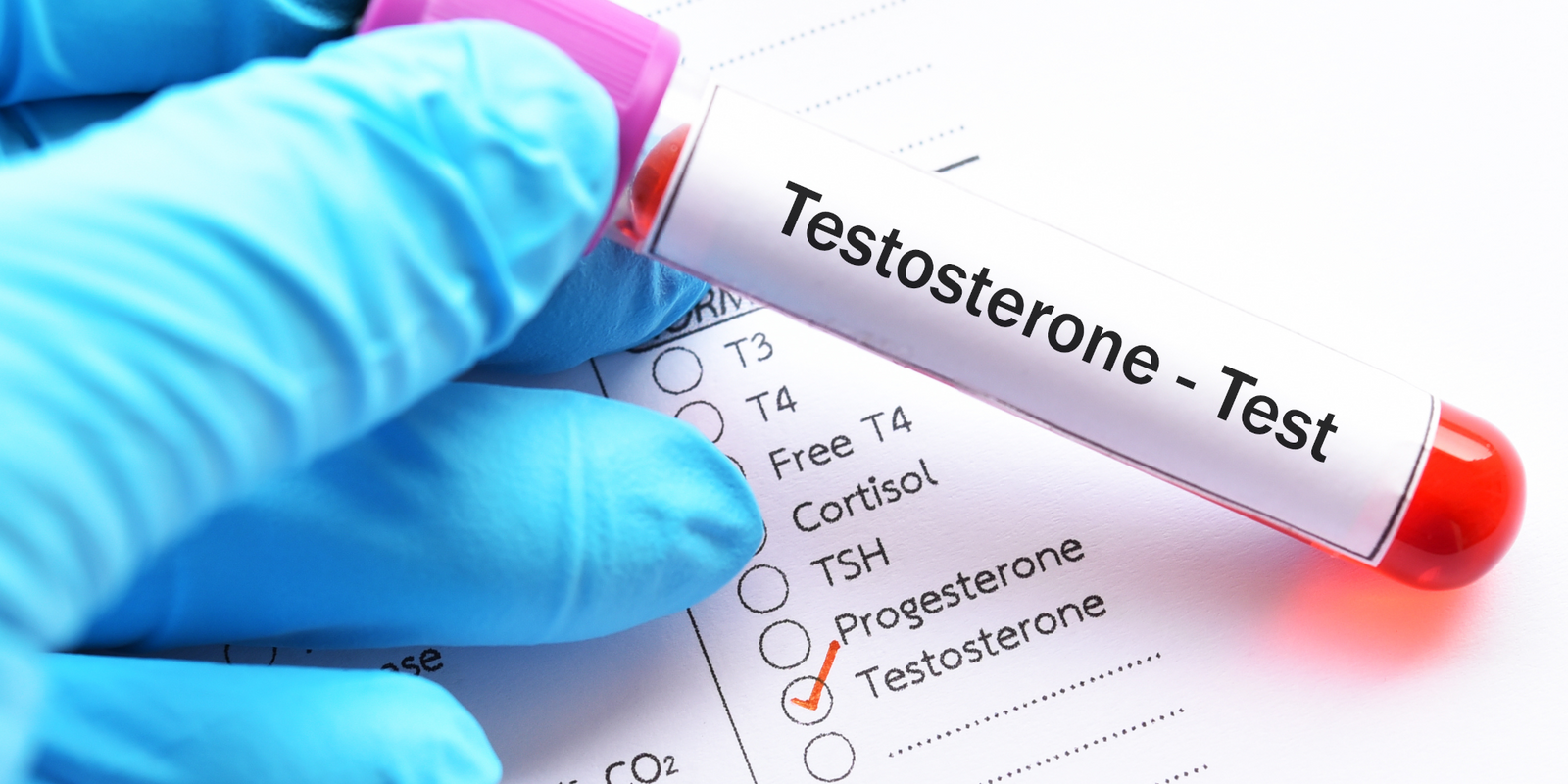 What To Look For In a Testosterone Booster: An Essential Checklist